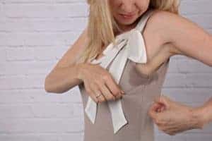 hyperhidrosis treatment