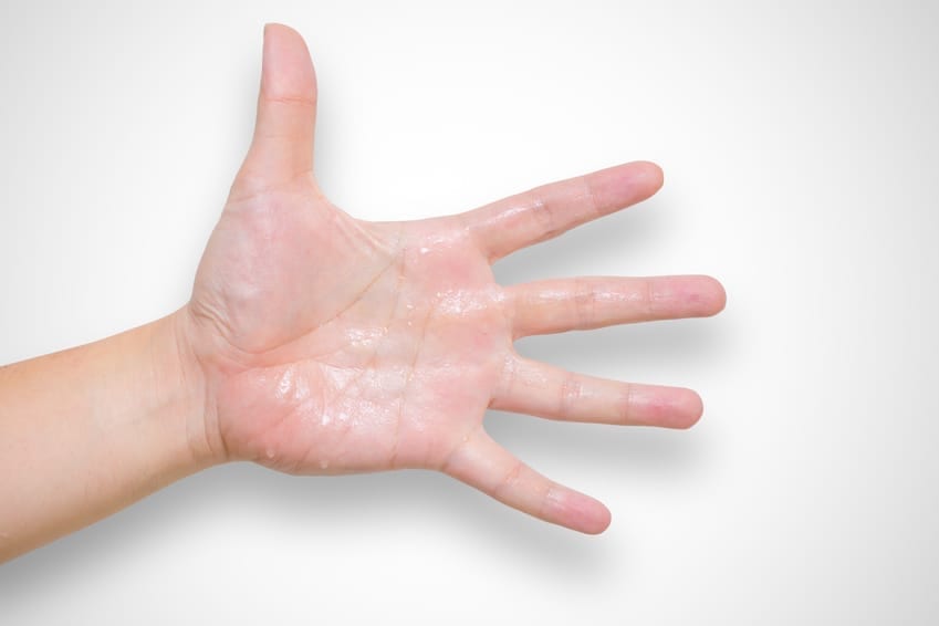 Could It Be Hyperhidrosis? When To Seek Treatment